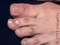 Common Foot Problems: Top 10 Issues and How to Treat Them Effectively