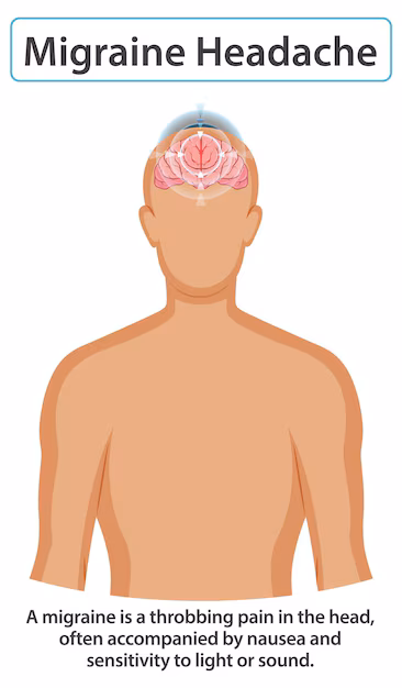 Understanding Migraines and Their Impact on Daily Life