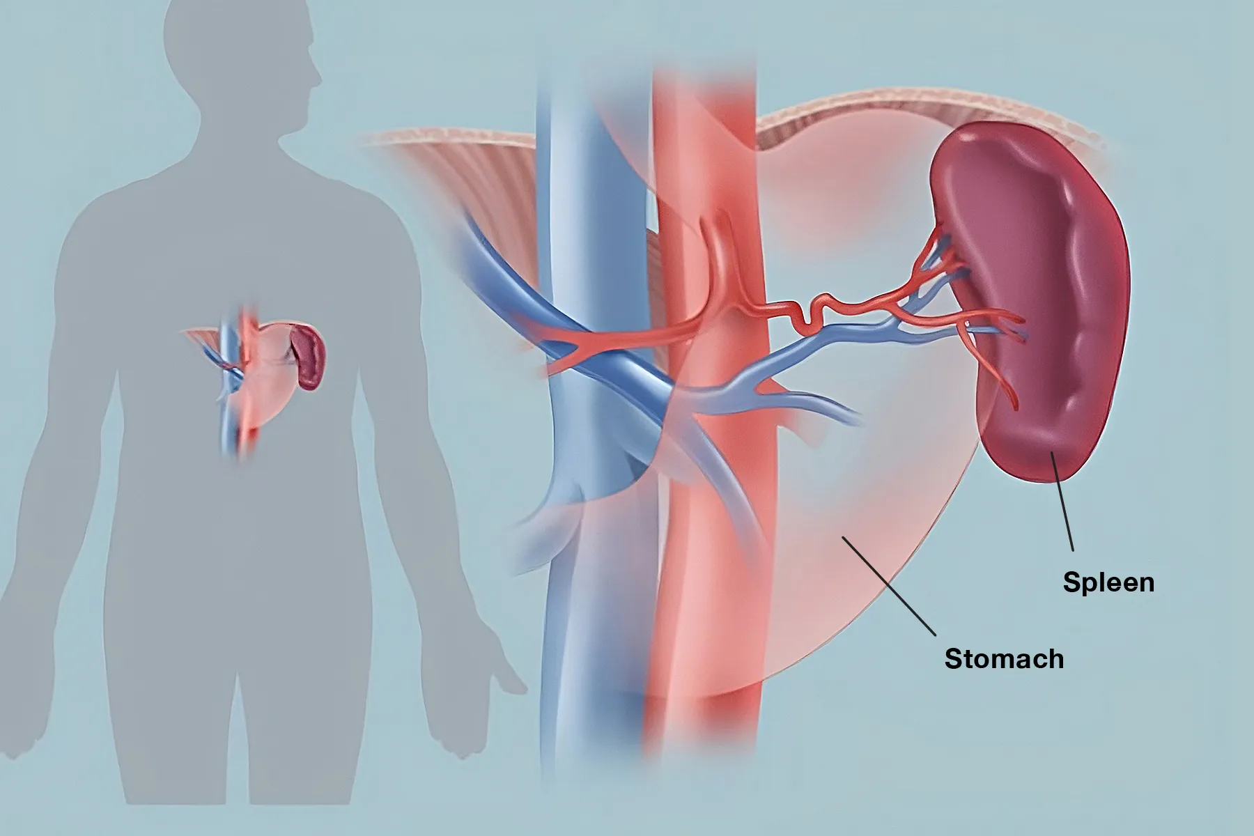 Enlarged Spleen Causes, Symptoms, and Modern Treatments